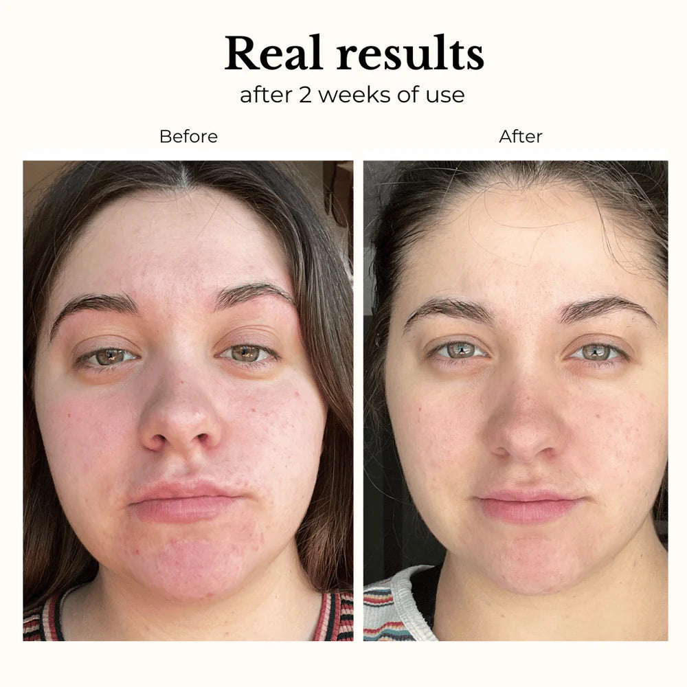 ROSE HYDRATING TONER WITH HYALURONIC ACID + ROOIBOS