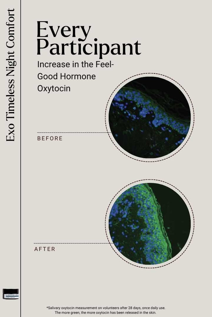 EXOSOMES | Exo Timeless Night Comfort