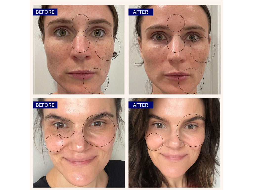 BRIGHTENING SERUM (VITAMIN C & E + HYALURONIC ACID)